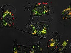 A gömb alakú nukleinsavaknak köszönhetően az 5-fluorouracil vegyület az állatkísérletekben a szokásosnál 20 000-szer hatékonyabb volt. (Kép forrása: Northwestern University)