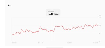 Pulzusmérés a Xiaomi Smart Band 10 Pro segítségével
