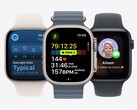 megérkezett a watchOS 26, amely számos új funkciót hoz a Apple Watch-ra. (Kép forrása: Apple)