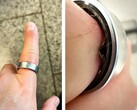 Egy Samsung Galaxy Ring, amelynek akkumulátora feldagadt, arra kényszerített egy felhasználót, hogy kórházba menjen. (Kép forrása: Zone of Tech)