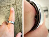 Egy Samsung Galaxy Ring, amelynek akkumulátora feldagadt, arra kényszerített egy felhasználót, hogy kórházba menjen. (Kép forrása: Zone of Tech)