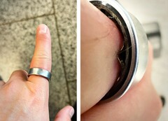 Egy Samsung Galaxy Ring, amelynek akkumulátora feldagadt, arra kényszerített egy felhasználót, hogy kórházba menjen. (Kép forrása: Zone of Tech)