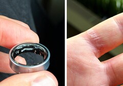 A megduzzadt akkumulátor a Galaxy gyűrűben fájdalmas lehet. (Kép forrása: Zone of Tech)