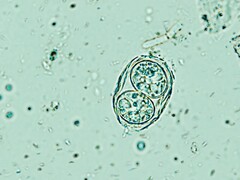 A Toxoplasma gondii itt a fertőző tojásszerű formában látható. (A kép forrása: Todorean Gabriel/iStock/Getty Images Plus)