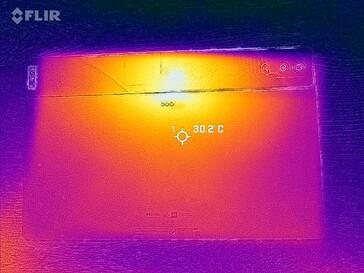 Thermal imaging: back