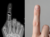 A Bone Biologics szabadalmat nyújt be új csontregenerációs technológiára (Kép forrása: AI-generált illusztratív kép)
