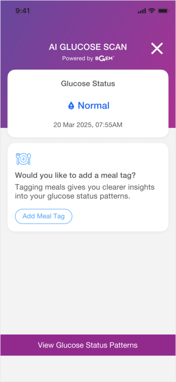 Az intelligens gyűrű hasznos lehet bizonyos ételek és a felhasználó vércukorszintje közötti összefüggések felfedezésében