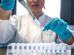 Az Oxford BioTherapeutics és a Roche stratégiai partnerséget jelent be a rákterápiák terén (Kép forrása: Julia Koblitz, Unsplash)