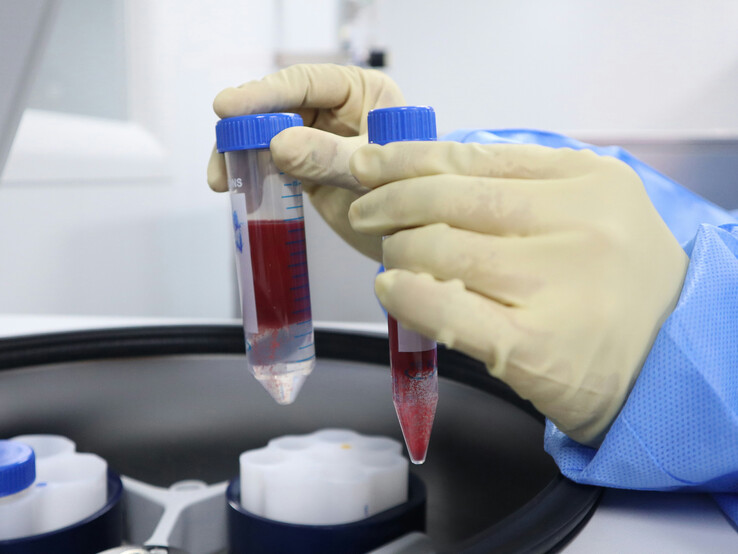 A Synnovis ellátási lánc kibertámadása által megzavart NHS-szolgáltatások között voltak a vérvizsgálati laboratóriumok (Kép forrása: Unsplash / Malcolm Choong)