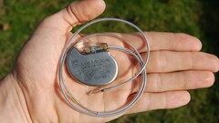 Hagyományos pacemaker. (Kép forrása: Wikimedia Commons)