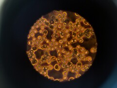 Vérsejtek mikroszkóp alatt (Kép forrása: ThisisEngineering via Unsplash; kivágva)