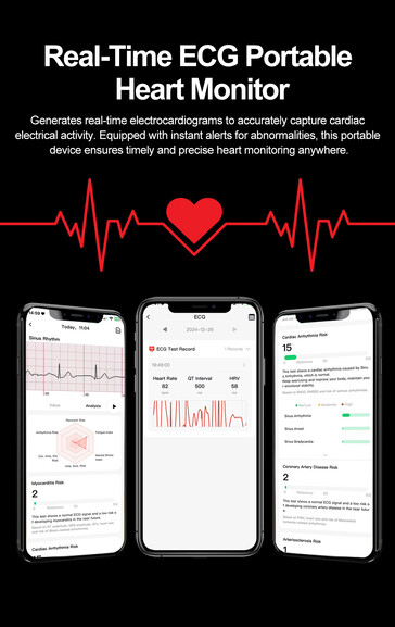 (Kép forrása: Rogbid)